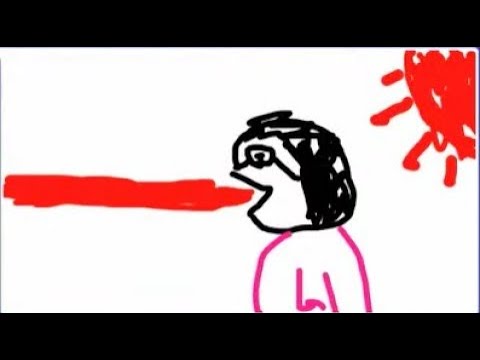 キ見る